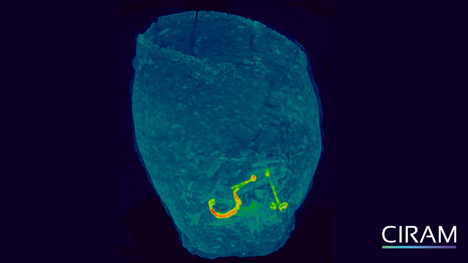 X-ray image of a funerary urn, revealing internal contents and structural details of the ceramic vessel