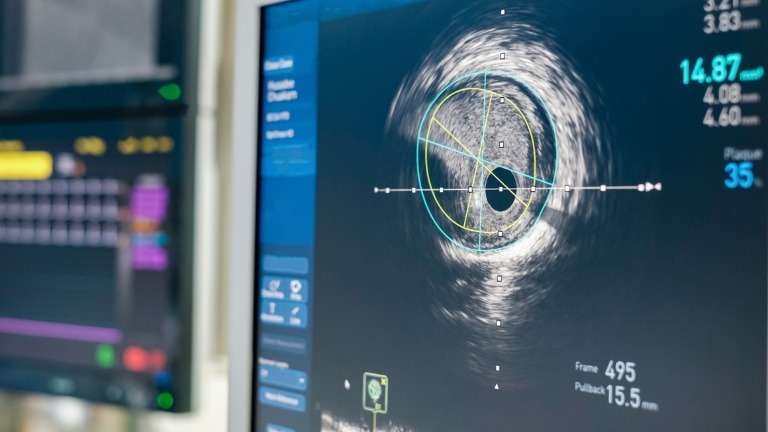 Scientific imaging: how does optics differ from radiography?